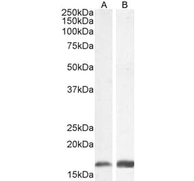 Western Blot - Anti-Iba1 Antibody (A82670) - Antibodies.com