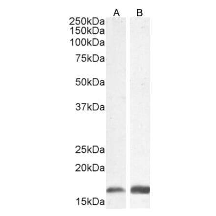 Western Blot - Anti-Iba1 Antibody (A82670) - Antibodies.com