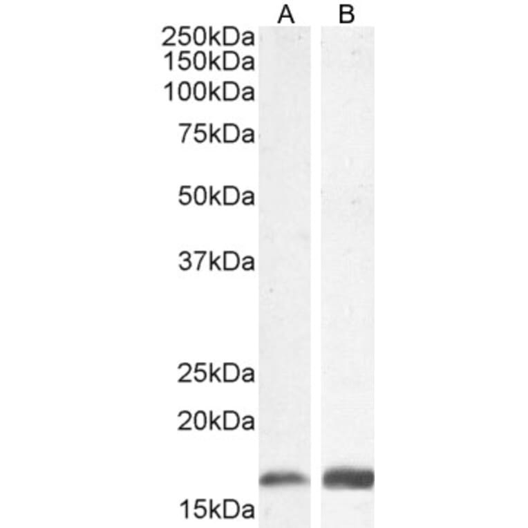 Western Blot - Anti-Iba1 Antibody (A82670) - Antibodies.com