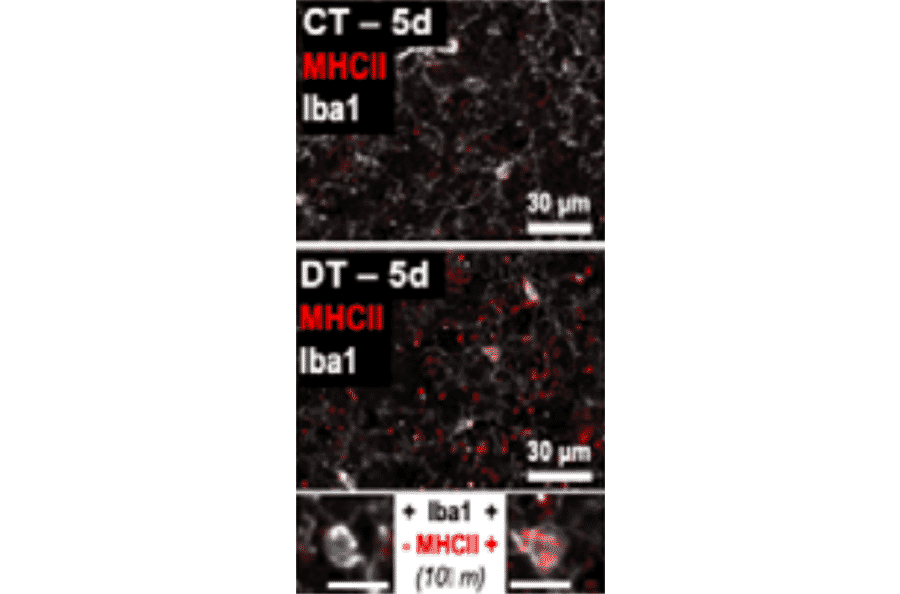 Immunofluorescence - Anti-Iba1 Antibody (A82670) - Antibodies.com Citation