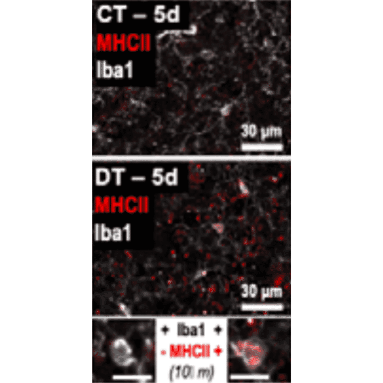 Immunofluorescence - Anti-Iba1 Antibody (A82670) - Antibodies.com Citation