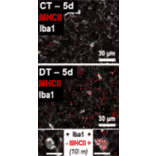 Immunofluorescence - Anti-Iba1 Antibody (A82670) - Antibodies.com Citation