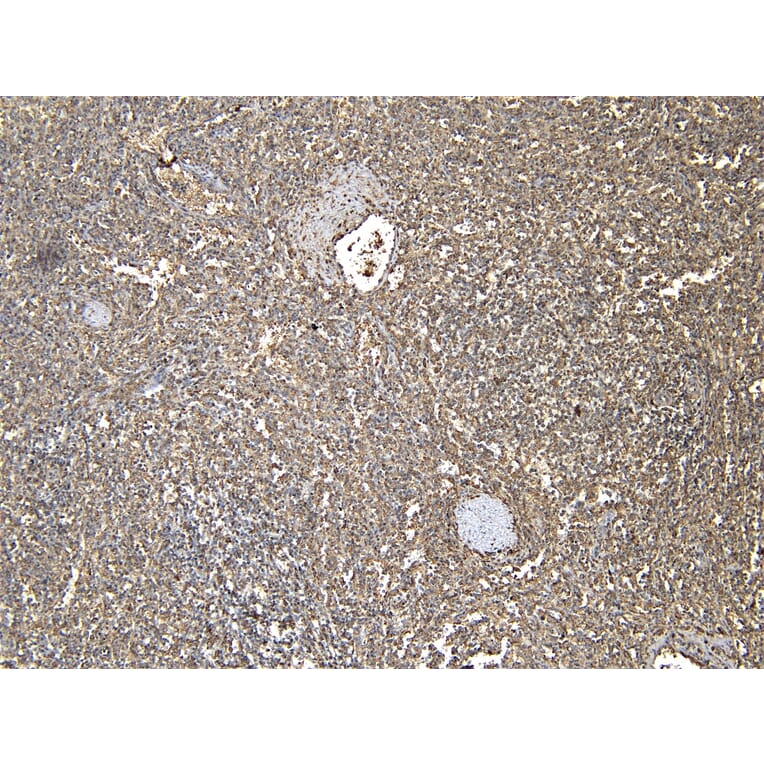 Immunohistochemistry - Anti-Iba1 Antibody (A82670) - Antibodies.com