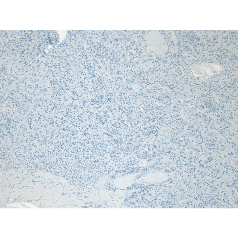 Immunohistochemistry - Anti-Iba1 Antibody (A82670) - Antibodies.com