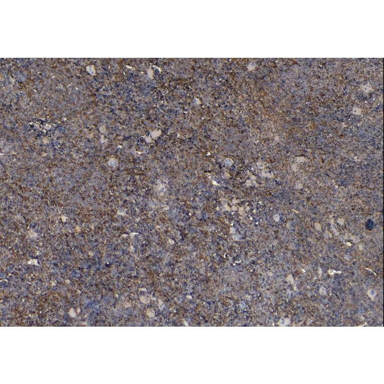 Immunohistochemistry - Anti-Iba1 Antibody (A82670) - Antibodies.com