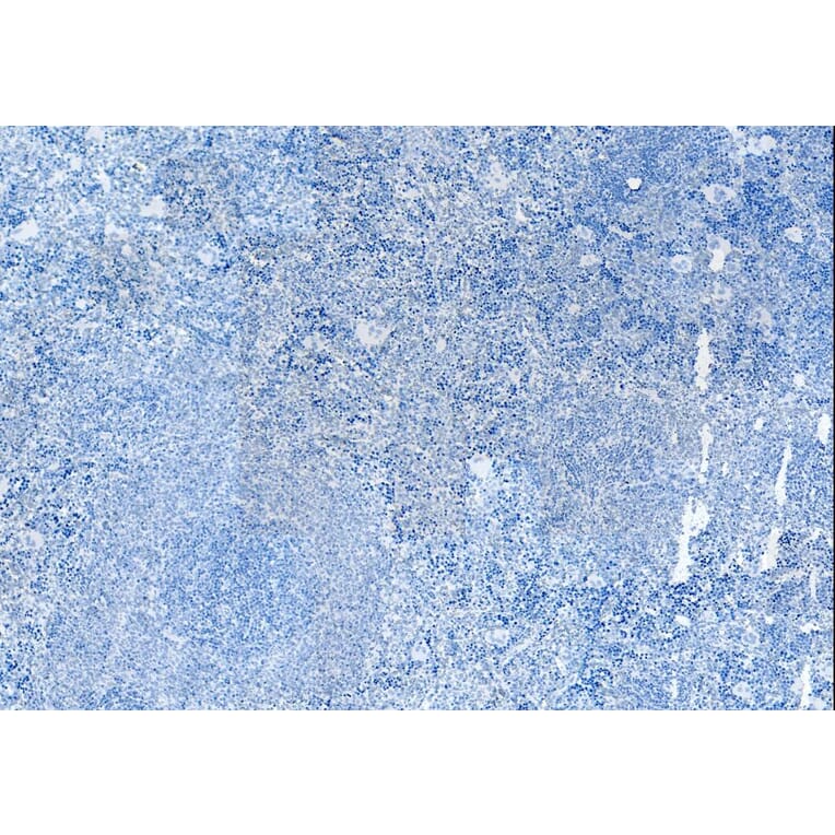 Immunohistochemistry - Anti-Iba1 Antibody (A82670) - Antibodies.com