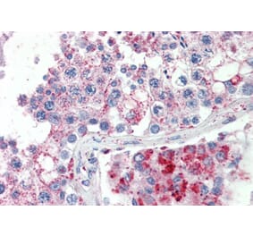 Immunohistochemistry - Anti-SPAG16 Antibody (A82672) - Antibodies.com