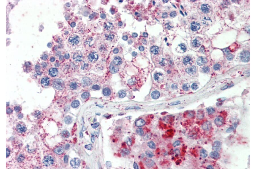 Immunohistochemistry - Anti-SPAG16 Antibody (A82672) - Antibodies.com