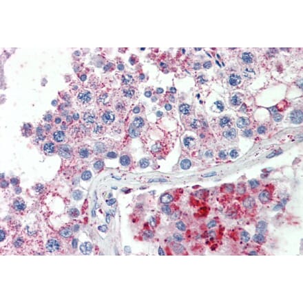 Immunohistochemistry - Anti-SPAG16 Antibody (A82672) - Antibodies.com