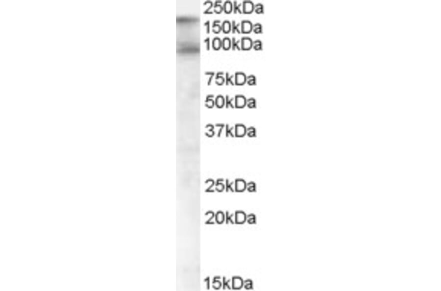 Western Blot - Anti-CDCP1 Antibody (A82673) - Antibodies.com