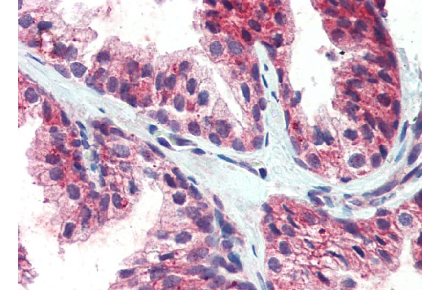 Immunohistochemistry - Anti-CDCP1 Antibody (A82673) - Antibodies.com