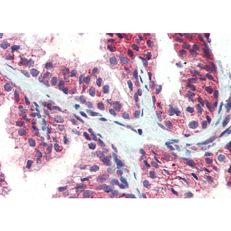 Immunohistochemistry - Anti-CDCP1 Antibody (A82673) - Antibodies.com