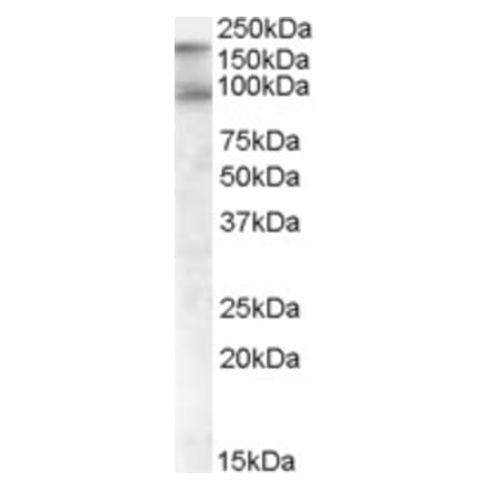 Western Blot - Anti-CDCP1 Antibody (A82673) - Antibodies.com
