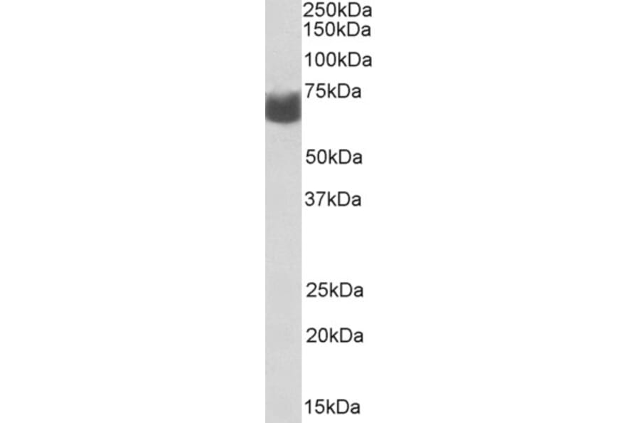 Western Blot - Anti-AMHR2 Antibody (A82674) - Antibodies.com