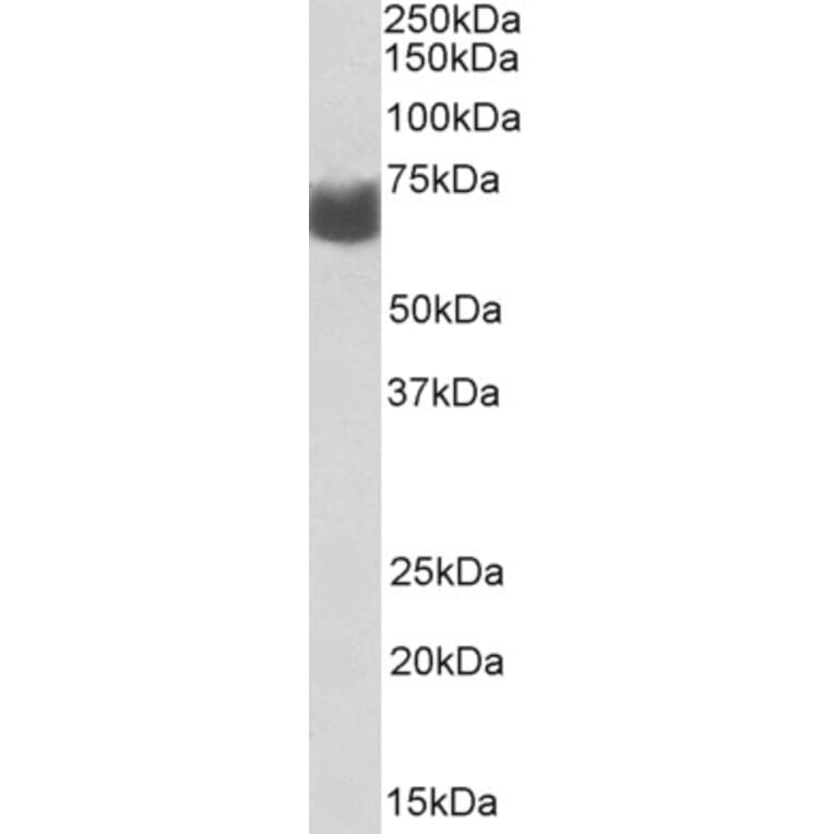 Western Blot - Anti-AMHR2 Antibody (A82674) - Antibodies.com