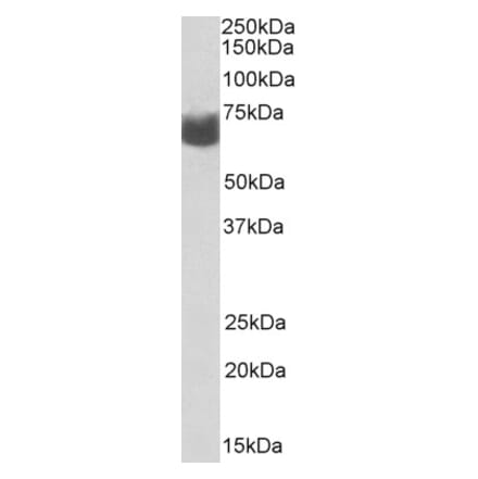 Western Blot - Anti-AMHR2 Antibody (A82674) - Antibodies.com