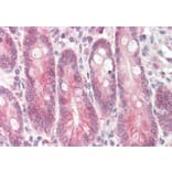 Immunohistochemistry - Anti-STAP2 Antibody (A82675) - Antibodies.com