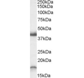 Western Blot - Anti-RAMP1 Antibody (A82677) - Antibodies.com