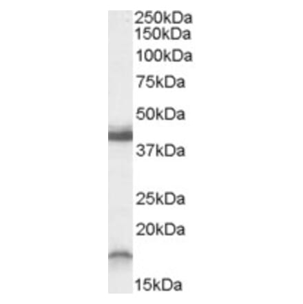 Western Blot - Anti-RAMP1 Antibody (A82677) - Antibodies.com