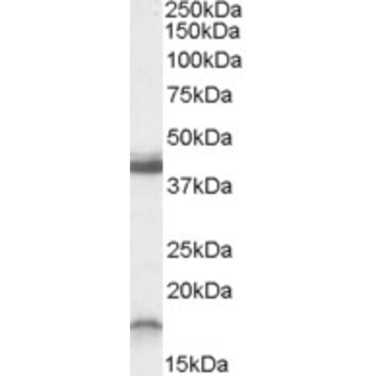 Western Blot - Anti-RAMP1 Antibody (A82677) - Antibodies.com