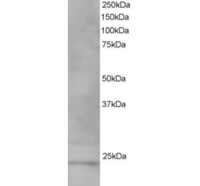 Western Blot - Anti-VPS28 Antibody (A82678) - Antibodies.com