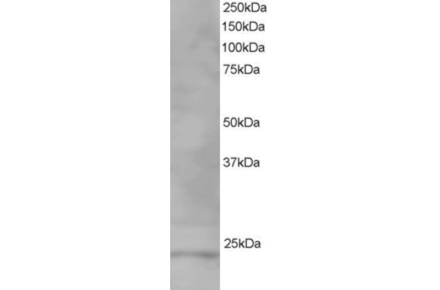 Western Blot - Anti-VPS28 Antibody (A82678) - Antibodies.com