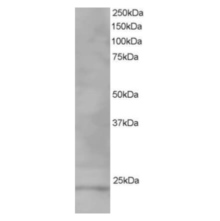 Western Blot - Anti-VPS28 Antibody (A82678) - Antibodies.com