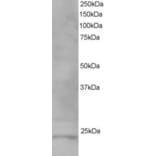Western Blot - Anti-VPS28 Antibody (A82678) - Antibodies.com