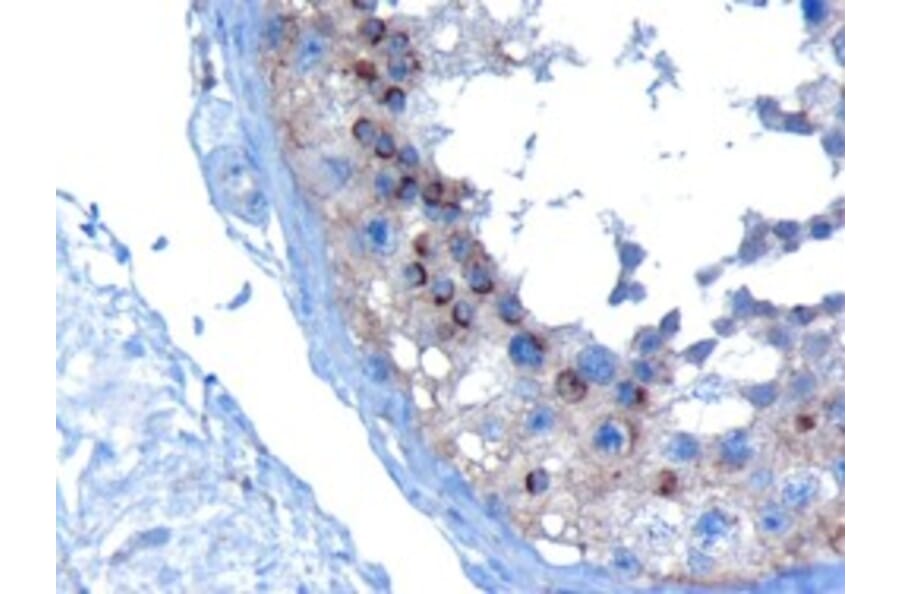 Immunohistochemistry - Anti-VPS28 Antibody (A82678) - Antibodies.com