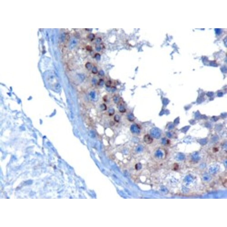 Immunohistochemistry - Anti-VPS28 Antibody (A82678) - Antibodies.com
