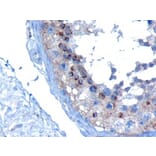 Immunohistochemistry - Anti-VPS28 Antibody (A82678) - Antibodies.com