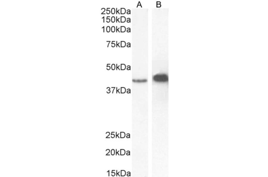 Western Blot - Anti-AMACR Antibody (A82679) - Antibodies.com