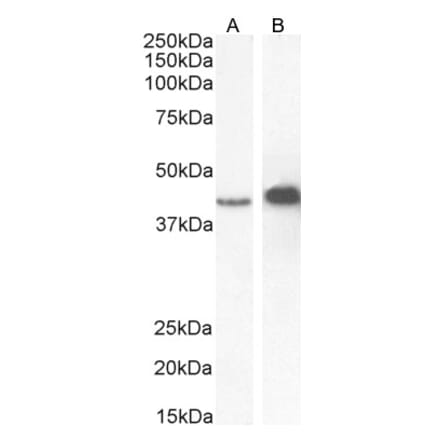 Western Blot - Anti-AMACR Antibody (A82679) - Antibodies.com