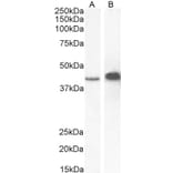 Western Blot - Anti-AMACR Antibody (A82679) - Antibodies.com