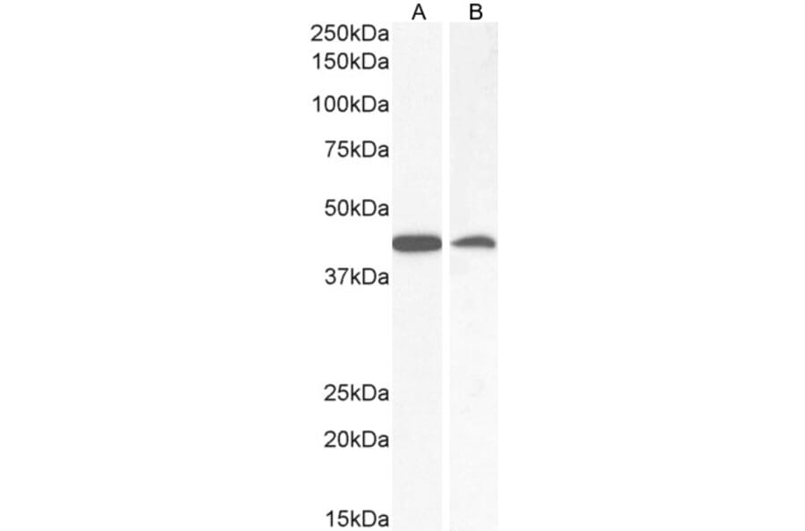 Western Blot - Anti-AMACR Antibody (A82679) - Antibodies.com