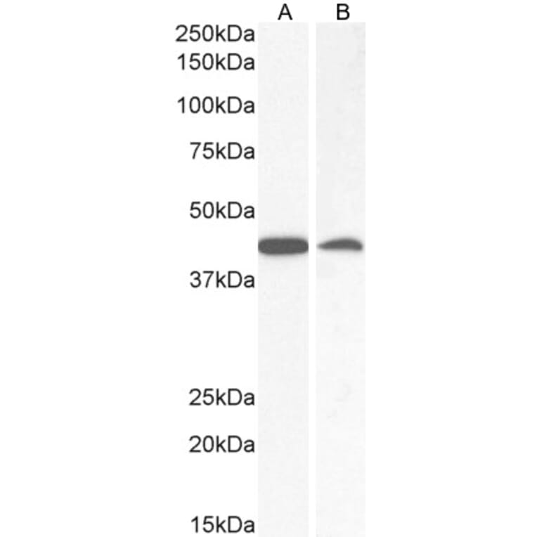 Western Blot - Anti-AMACR Antibody (A82679) - Antibodies.com