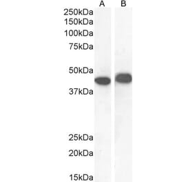 Western Blot - Anti-AMACR Antibody (A82680) - Antibodies.com