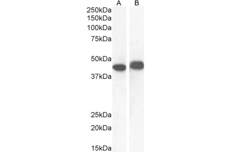 Western Blot - Anti-AMACR Antibody (A82680) - Antibodies.com