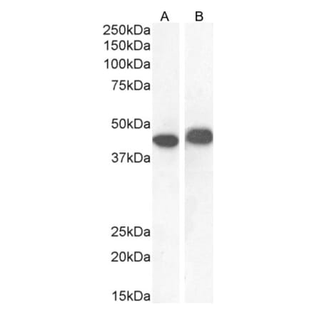 Western Blot - Anti-AMACR Antibody (A82680) - Antibodies.com