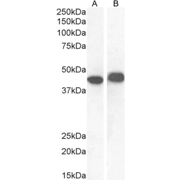 Western Blot - Anti-AMACR Antibody (A82680) - Antibodies.com