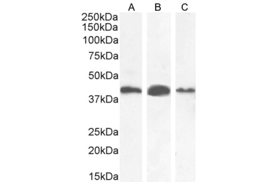 Western Blot - Anti-AMACR Antibody (A82680) - Antibodies.com