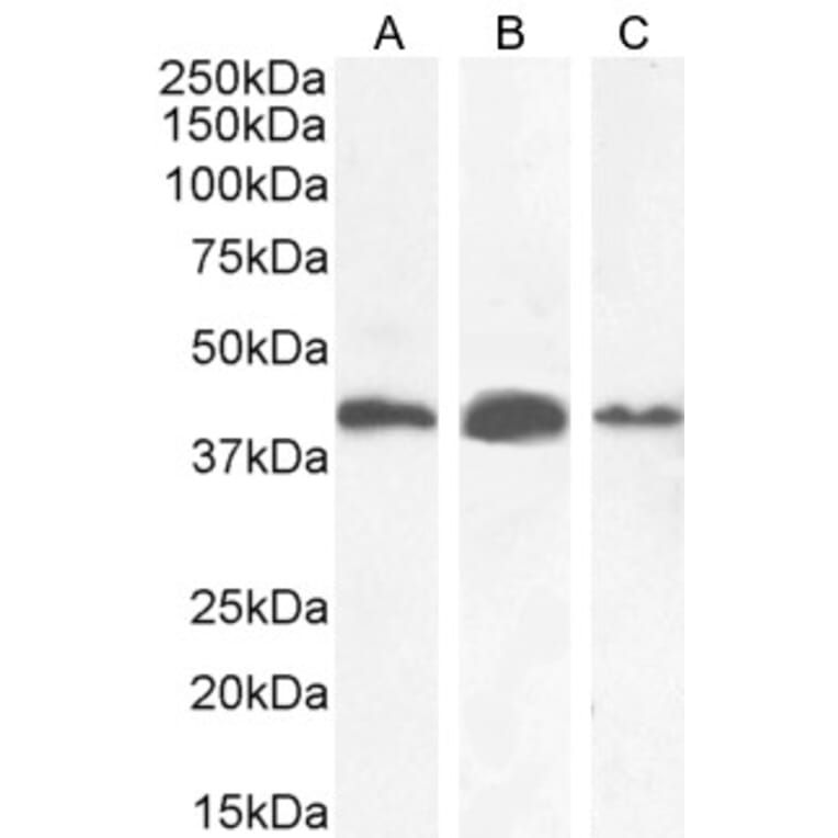 Western Blot - Anti-AMACR Antibody (A82680) - Antibodies.com