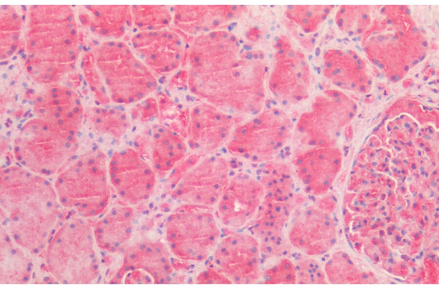 Immunohistochemistry - Anti-AMACR Antibody (A82680) - Antibodies.com