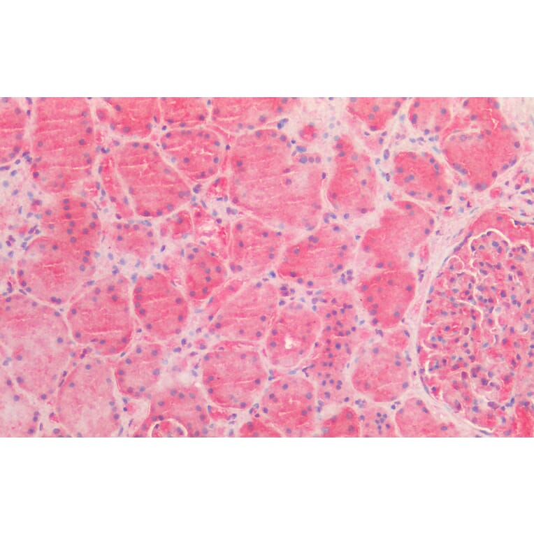 Immunohistochemistry - Anti-AMACR Antibody (A82680) - Antibodies.com