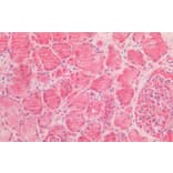 Immunohistochemistry - Anti-AMACR Antibody (A82680) - Antibodies.com