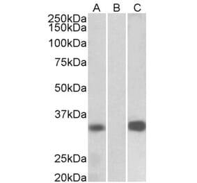 Western Blot - Anti-DREAM Antibody (A82682) - Antibodies.com