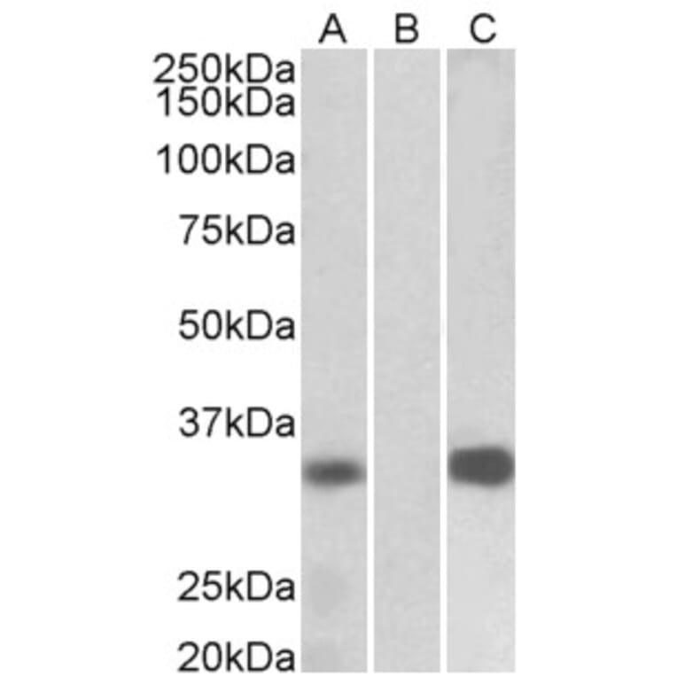 Western Blot - Anti-DREAM Antibody (A82682) - Antibodies.com
