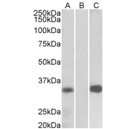 Western Blot - Anti-KCNIP3 Antibody (A82682) - Antibodies.com