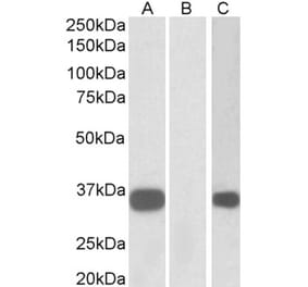Western Blot - Anti-KCNIP3 Antibody (A82683) - Antibodies.com
