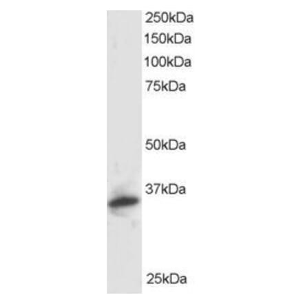 Western Blot - Anti-PSMF1 Antibody (A82685) - Antibodies.com